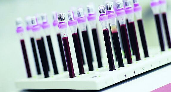 Blutentnahmeröhrchen