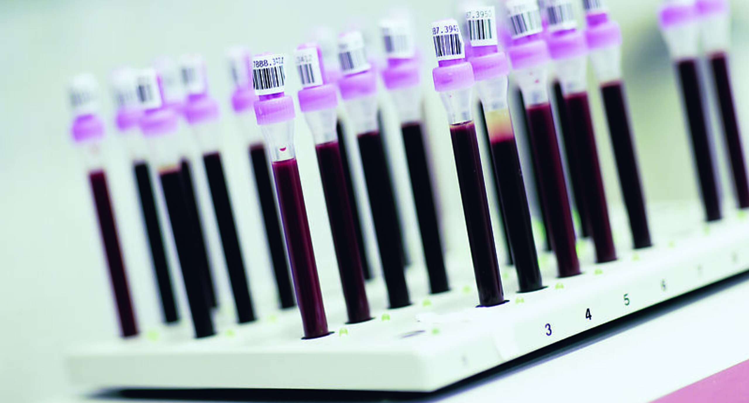 Blutentnahmeröhrchen