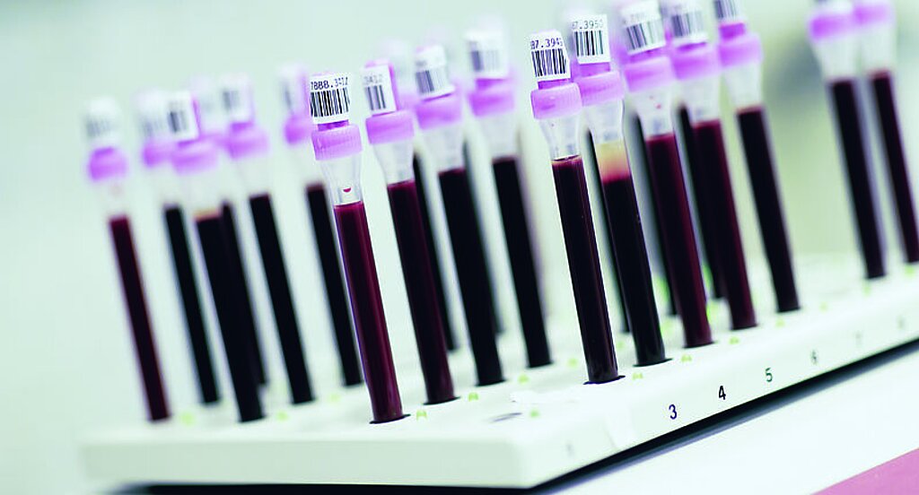 Blutentnahmeröhrchen