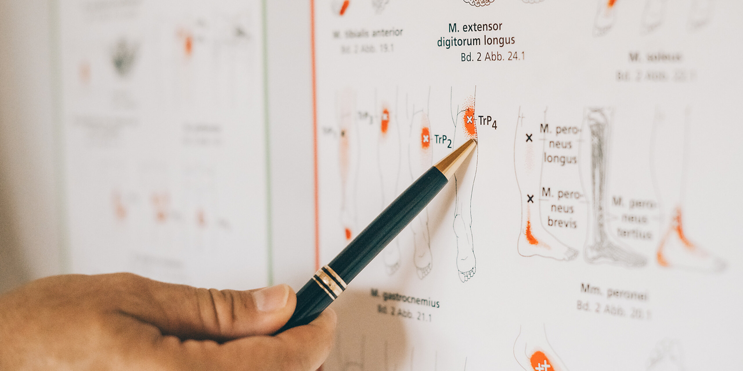 Jemand zeigt mit einem Stift auf ein Plakat mit Triggerpunkten.