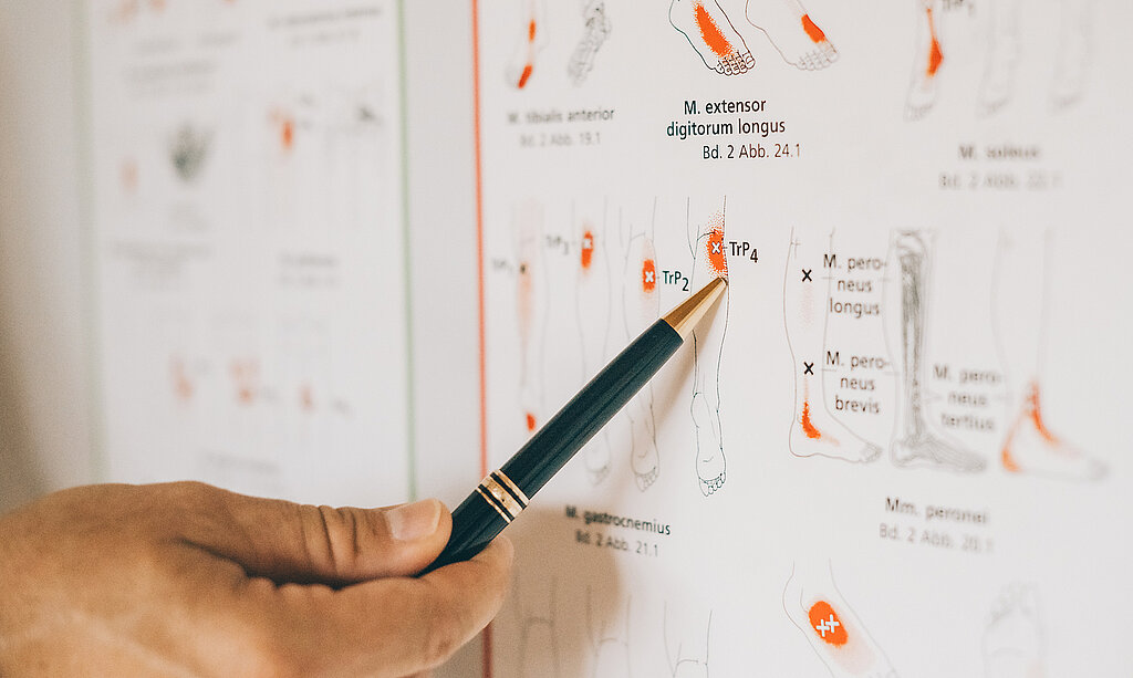 Jemand zeigt mit einem Stift auf ein Plakat mit Triggerpunkten.